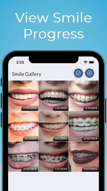 Braces Tracker