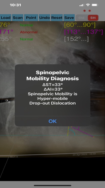 SpinopelvicMobilityApp screenshot-4