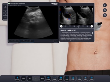 Wazo Ultrasound Simulator iPad screenshot 8