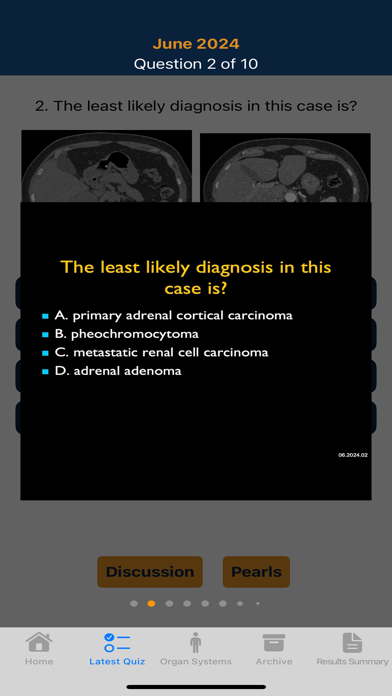 CTisus iQuiz 25 iPhone screenshot 5 - Medical app