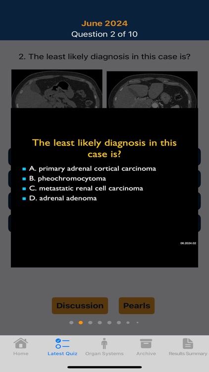 CTisus iQuiz 25 screenshot-4