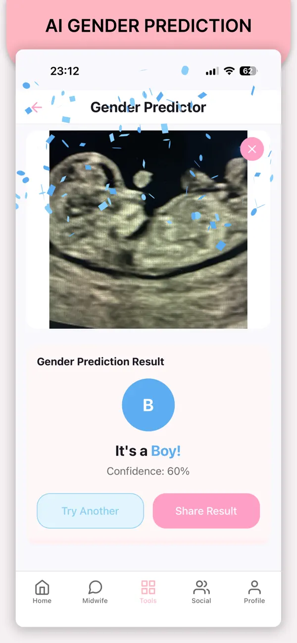 #5. Pregnancy AI (iOS) 由: Baby World AI