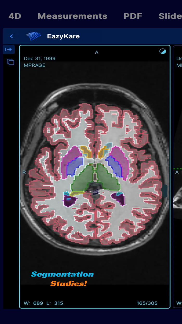 EazyGo  Easy PACS  DICOM