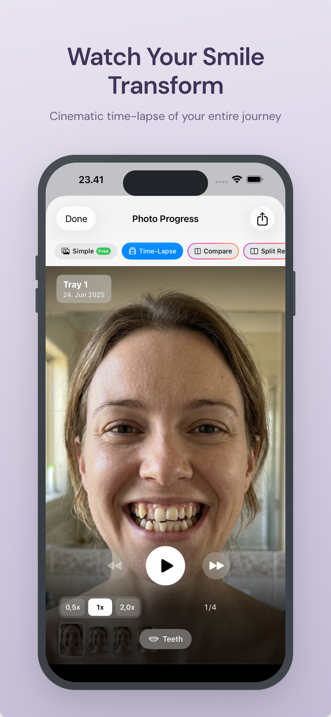 Smile Journey: Aligner Tracker