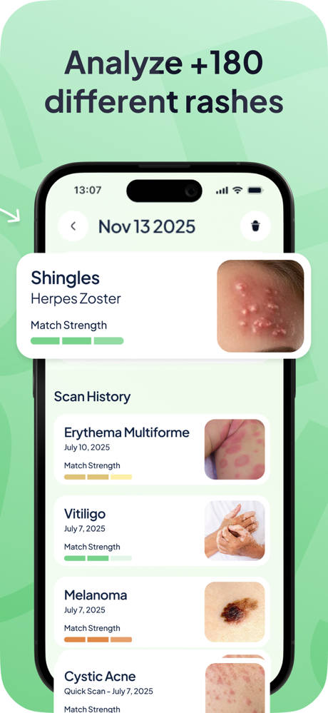 Rash ID: Skin Rash Identifier screenshot 2