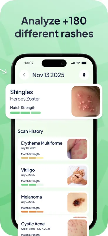 Rash ID: Skin Rash Identifier screenshot 2 of 7