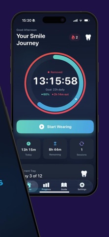 Clear aligners tracker screenshot