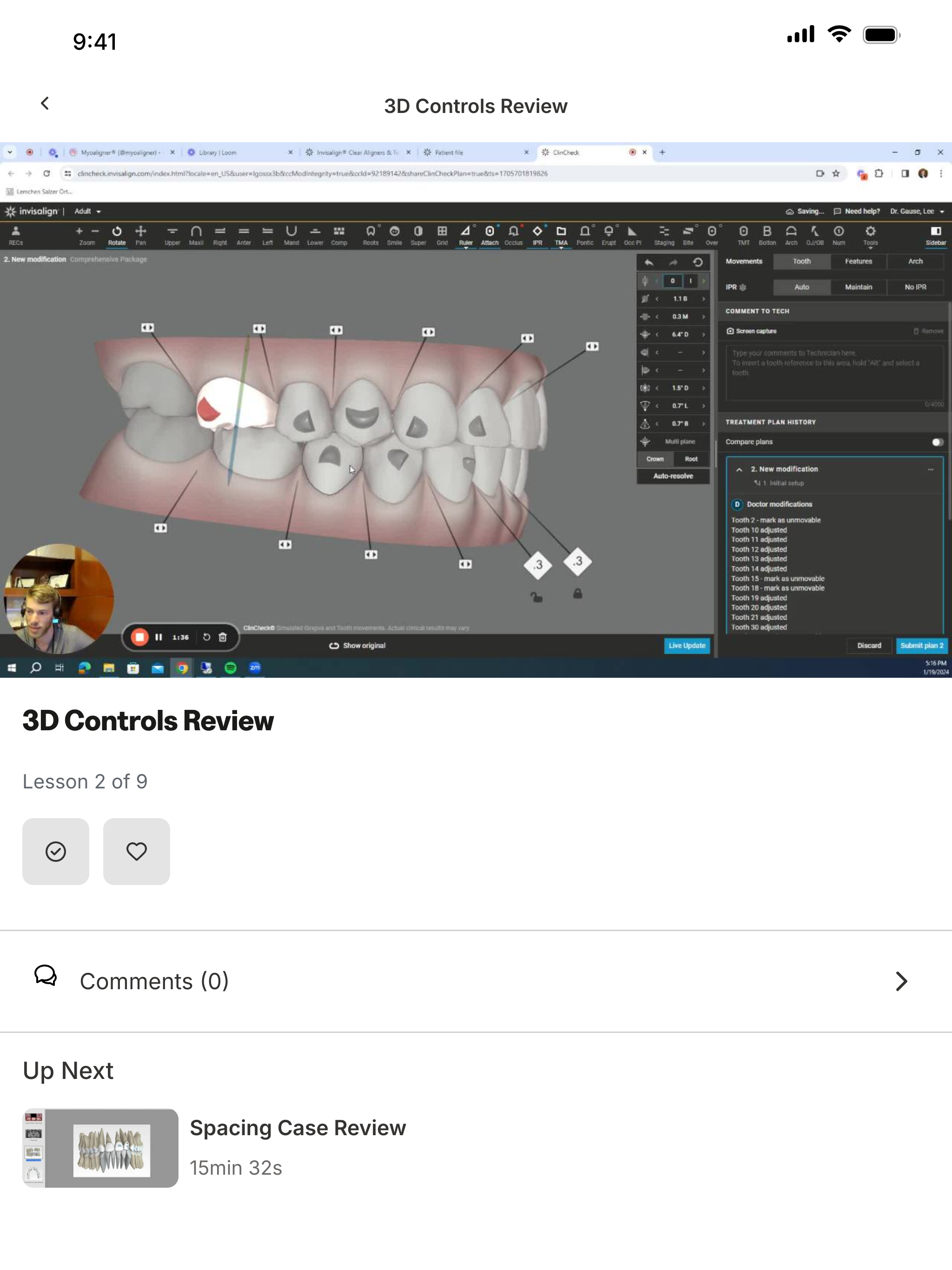 Clear Aligner Advisor