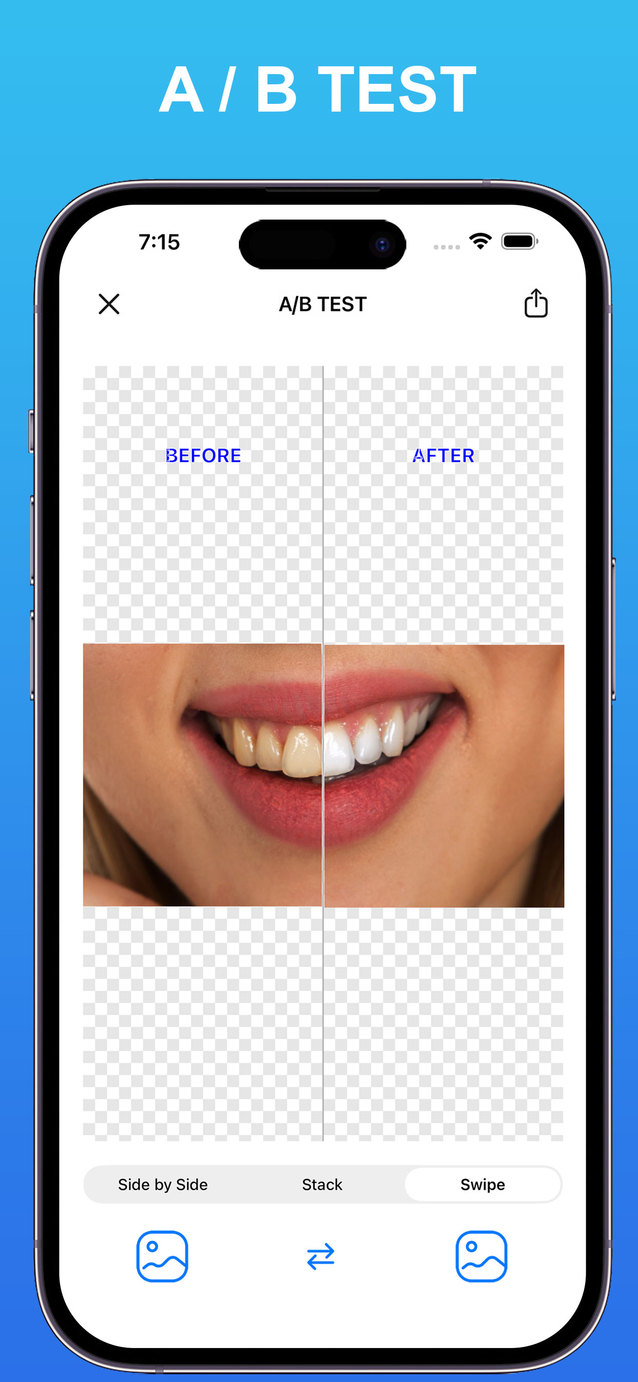 Dentcam - Dental Pro Camera screenshot 4
