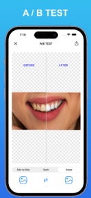 Dentcam - Dental Pro Camera screenshot