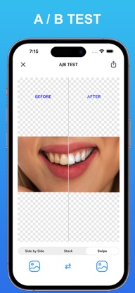 Dentcam - Dental Pro Camera screenshot 4
