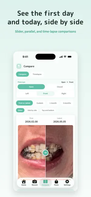 SmileProgress screenshot 2