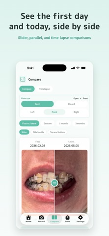 SmileProgress iPhone screenshot