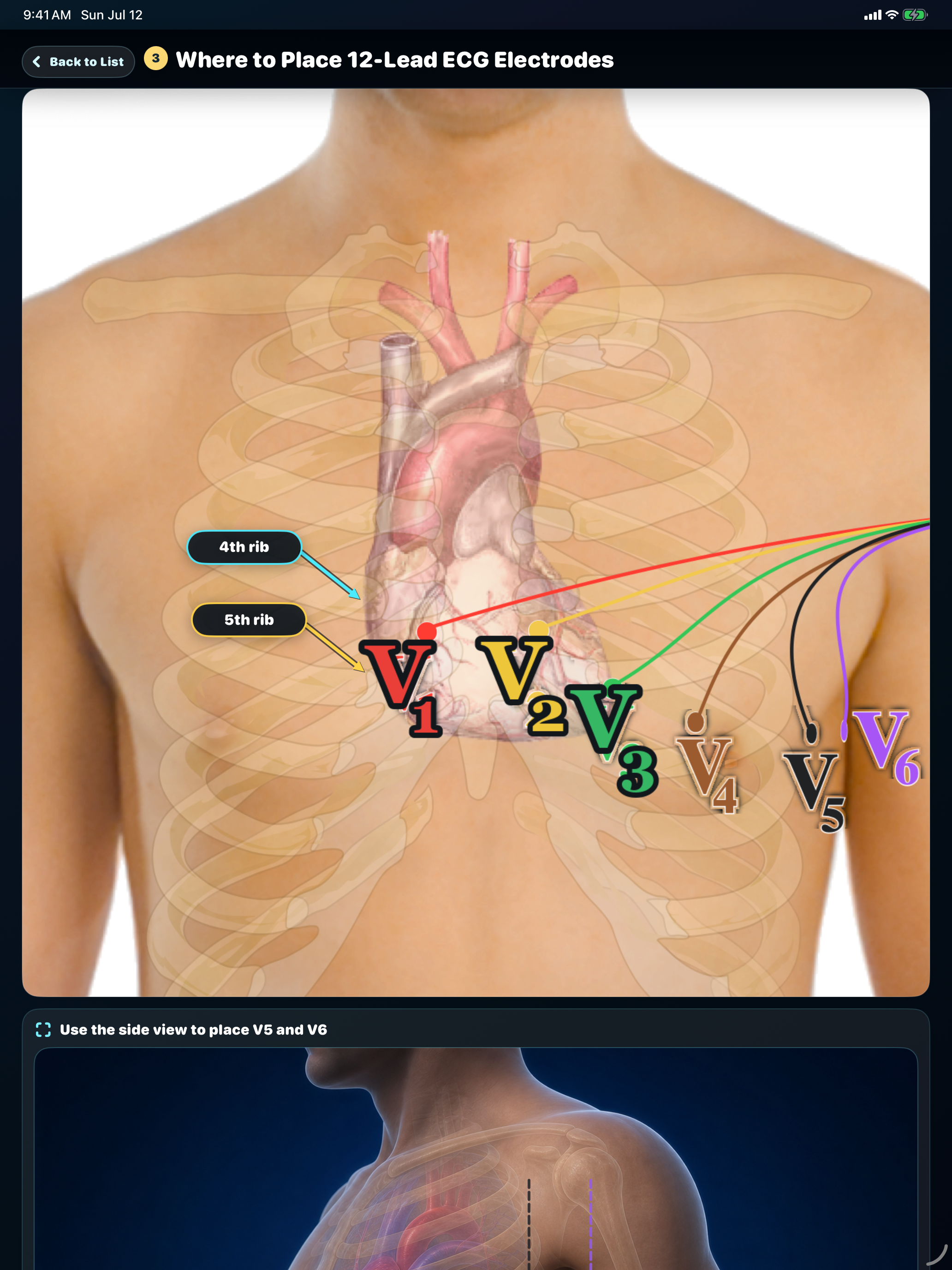 ECG Trainer: Monitor & 12-Lead screenshot 19