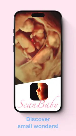 ScanBaby learn baby ultrasound screenshot 1