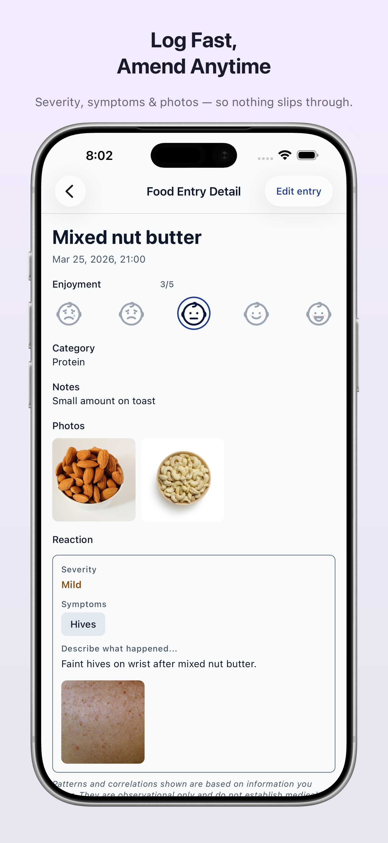 Log: Baby Solid Food & Allergy screenshot 5
