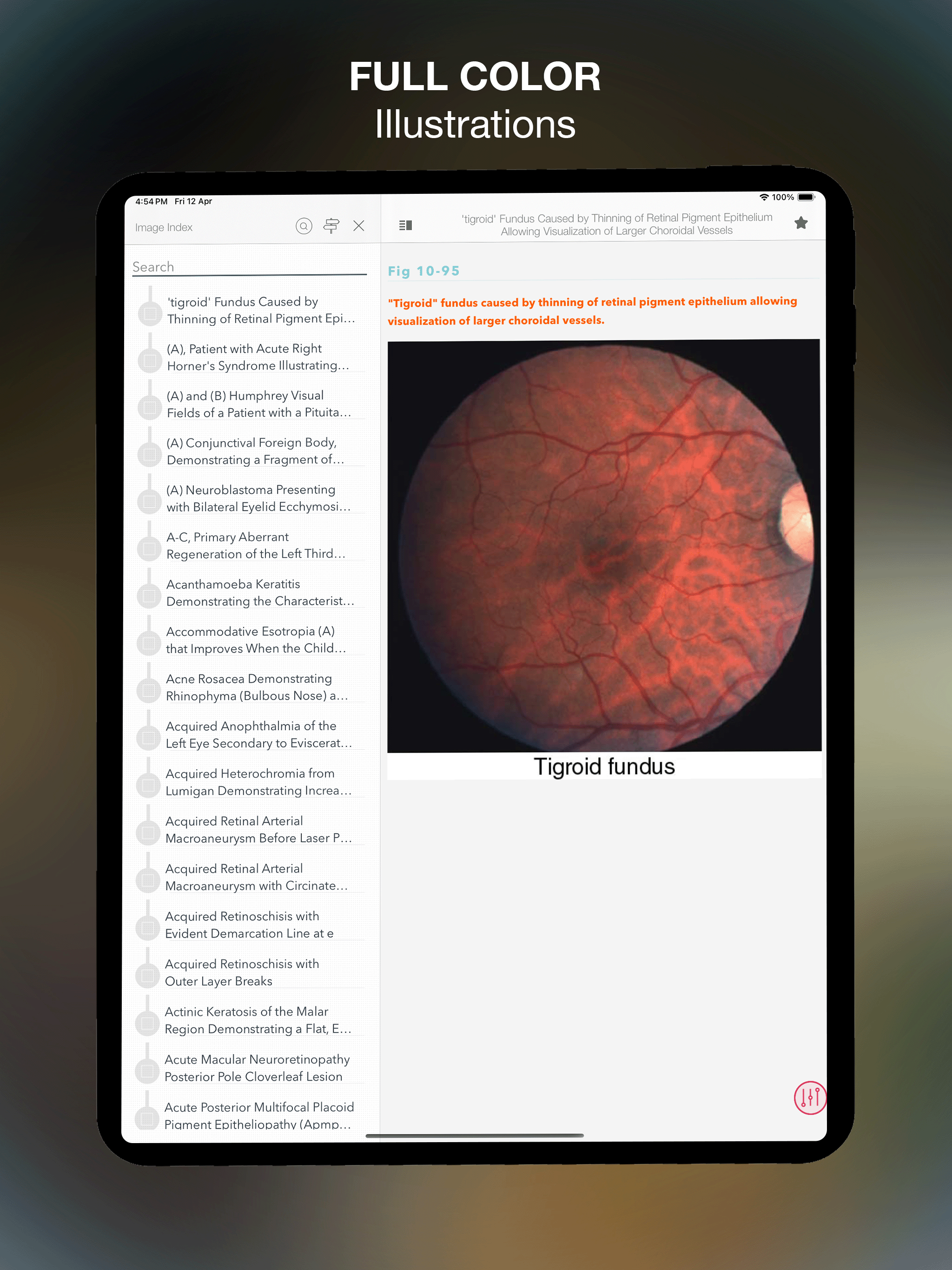 Mass Eye Ear Infirmary Manual