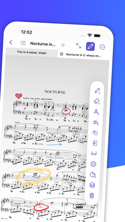 digitalScore, read sheet music