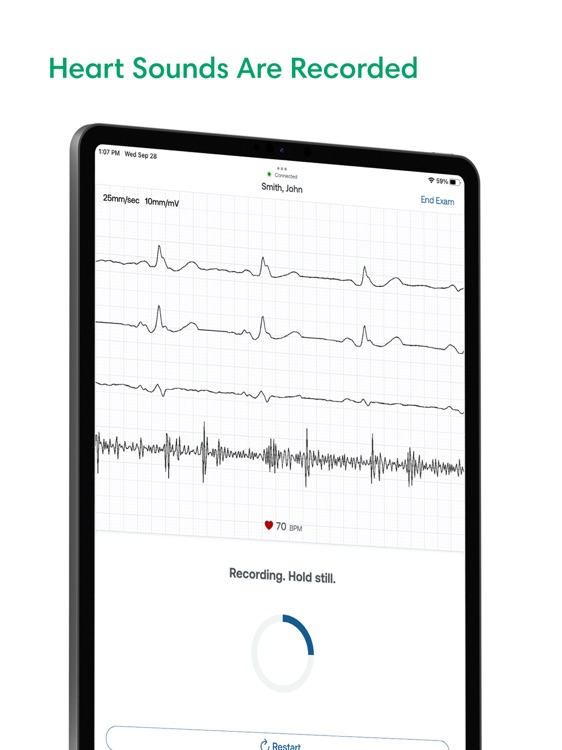 SENSORA™ by Eko Health