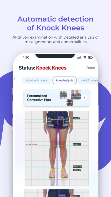 FlexiTrace Posture Analysis