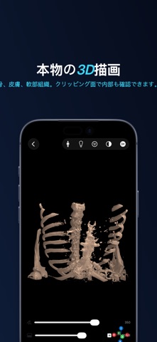 Lumen — DICOM ビューア のスクリーンショット