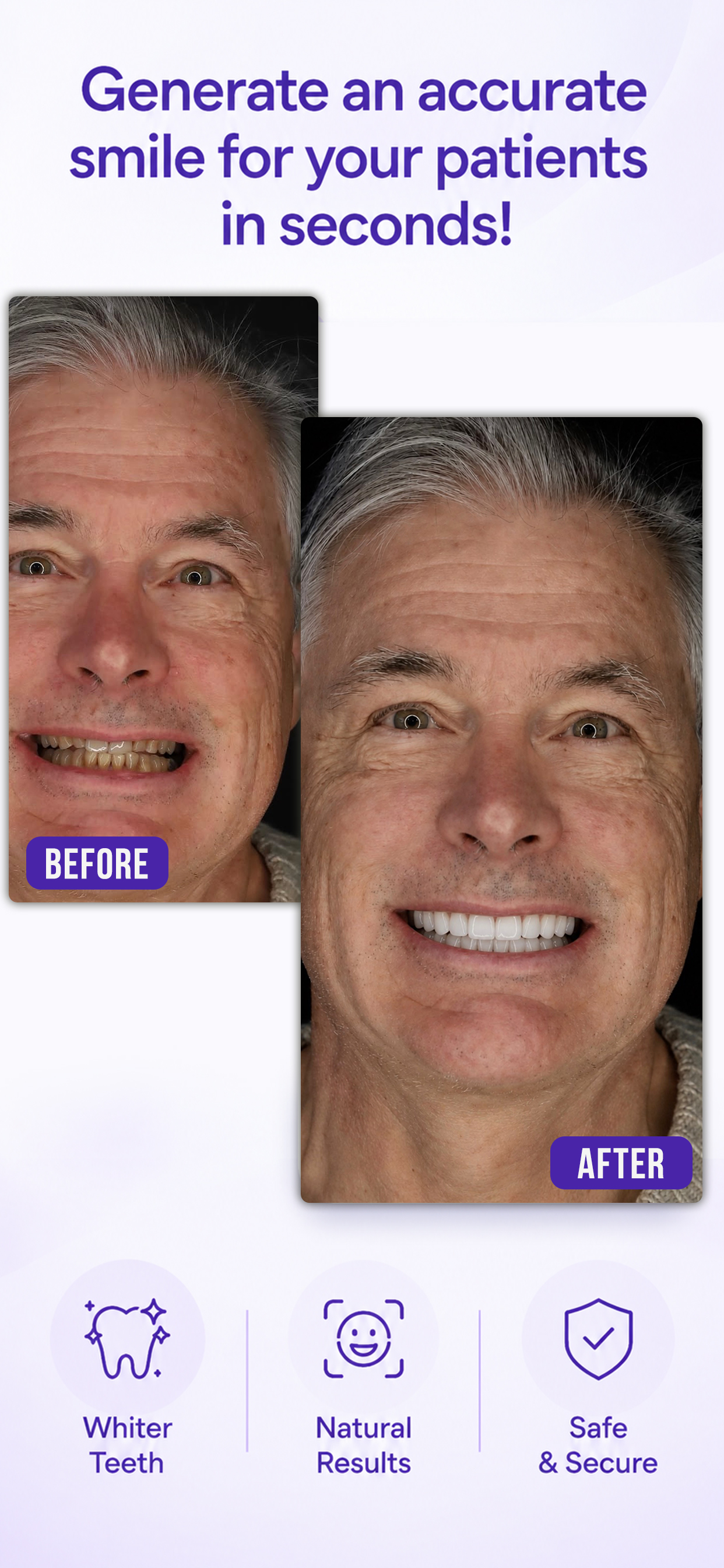 TrueSmile Smile Generator screenshot 2