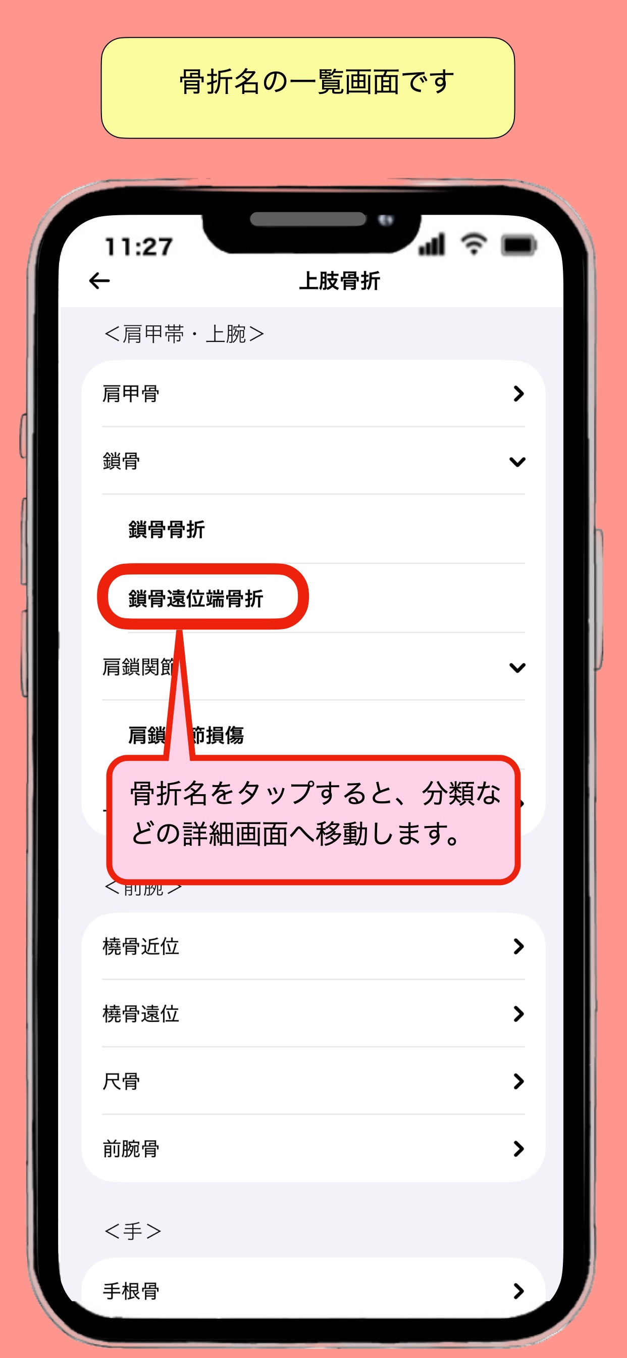 Screenshot 3 of 整形外科治療ガイド_骨折から理学所見まで