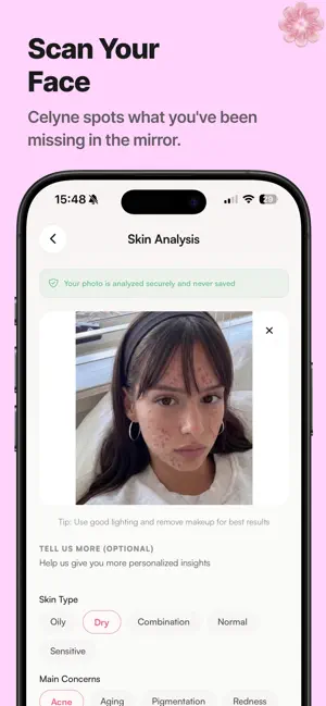 Celyne AI - Clear Skin AI screenshot 4