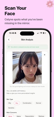 Celyne AI - Clear Skin AI screenshot