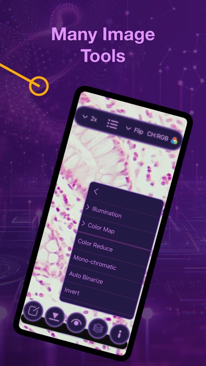 XScopy: μPhoto Elements