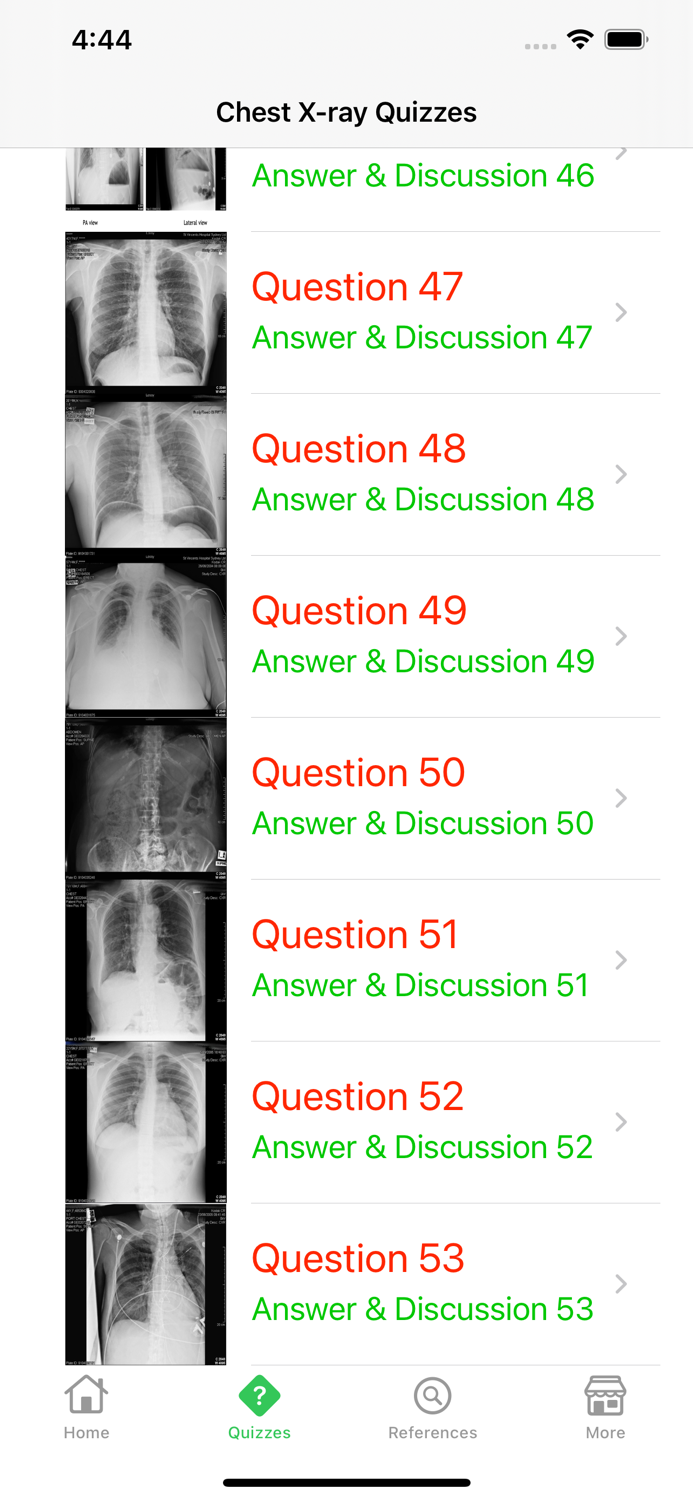 X-Ray Interpretation Guide