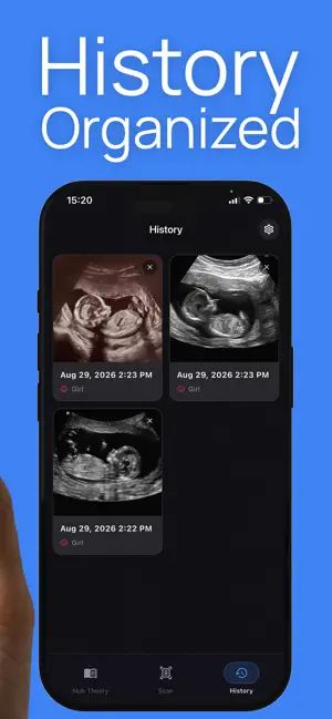 NubScan: Baby Gender AI screenshot 4