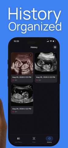 NubScan: Baby Gender AI iPhone screenshot