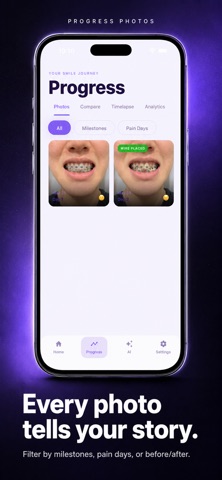 Bracer: Orthodontic Tracker Screenshot 6 of 7