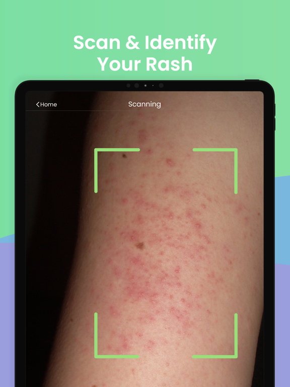 Screenshot #4 pour Rash ID - Skin Rash Identifier