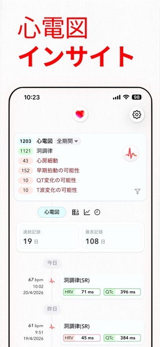 ECG+｜あなたのWatch心電図レポートを解説 スクリーンショット2