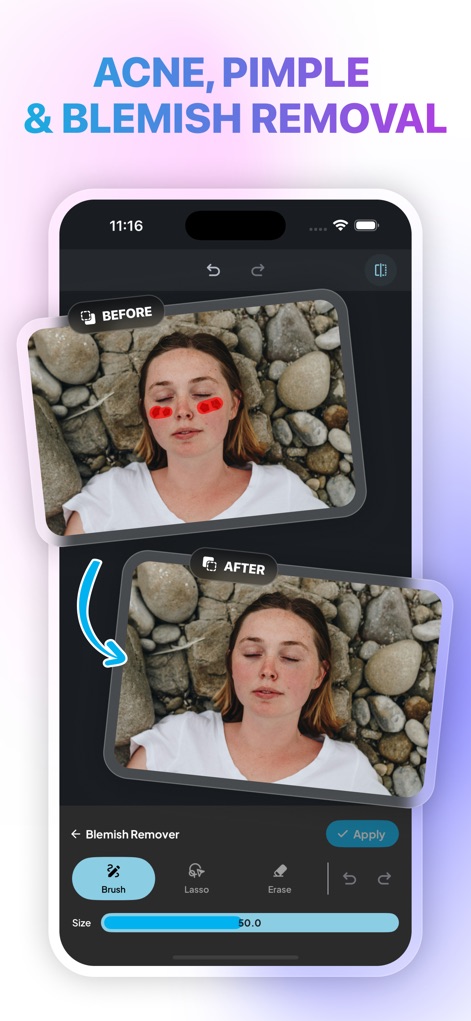 Photo Remove Unwanted Object - Con la funzione di ritocco, gli utenti possono eliminare facilmente imperfezioni come le macchie rosse evidenziate sul viso, ottenendo una pelle impeccabile e un aspetto naturale, come si vede nel confronto 'prima' e 'dopo'.