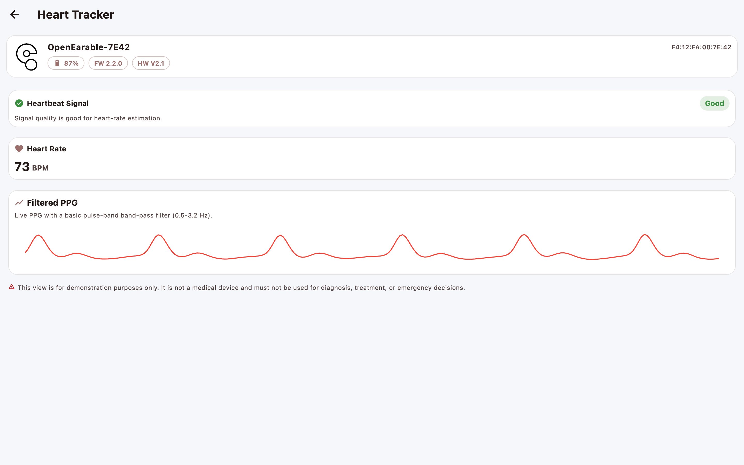 OpenWearable screenshot 21