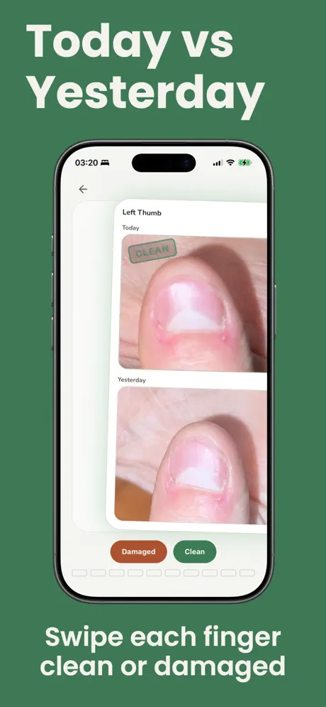 Nail Habit Tracker screenshot 3