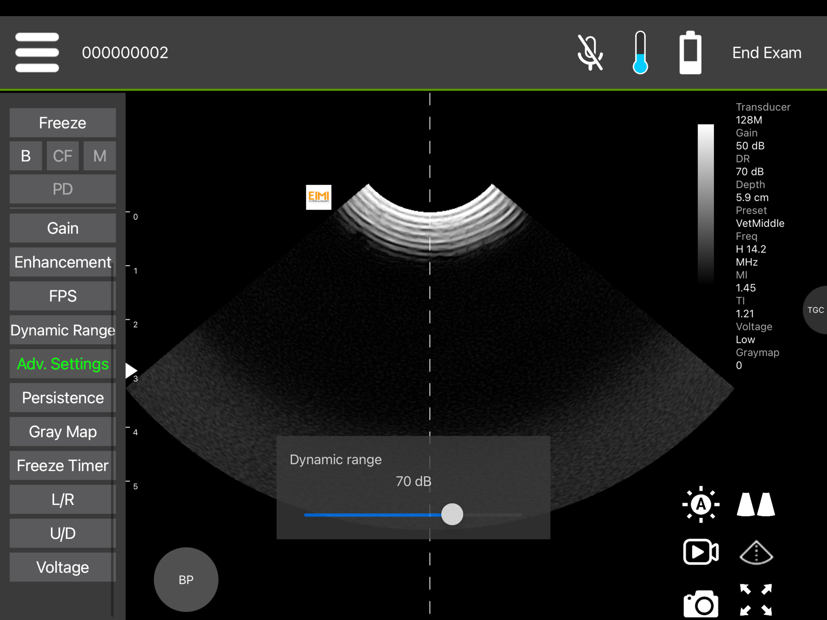 IBEX Wireless Ultrasound