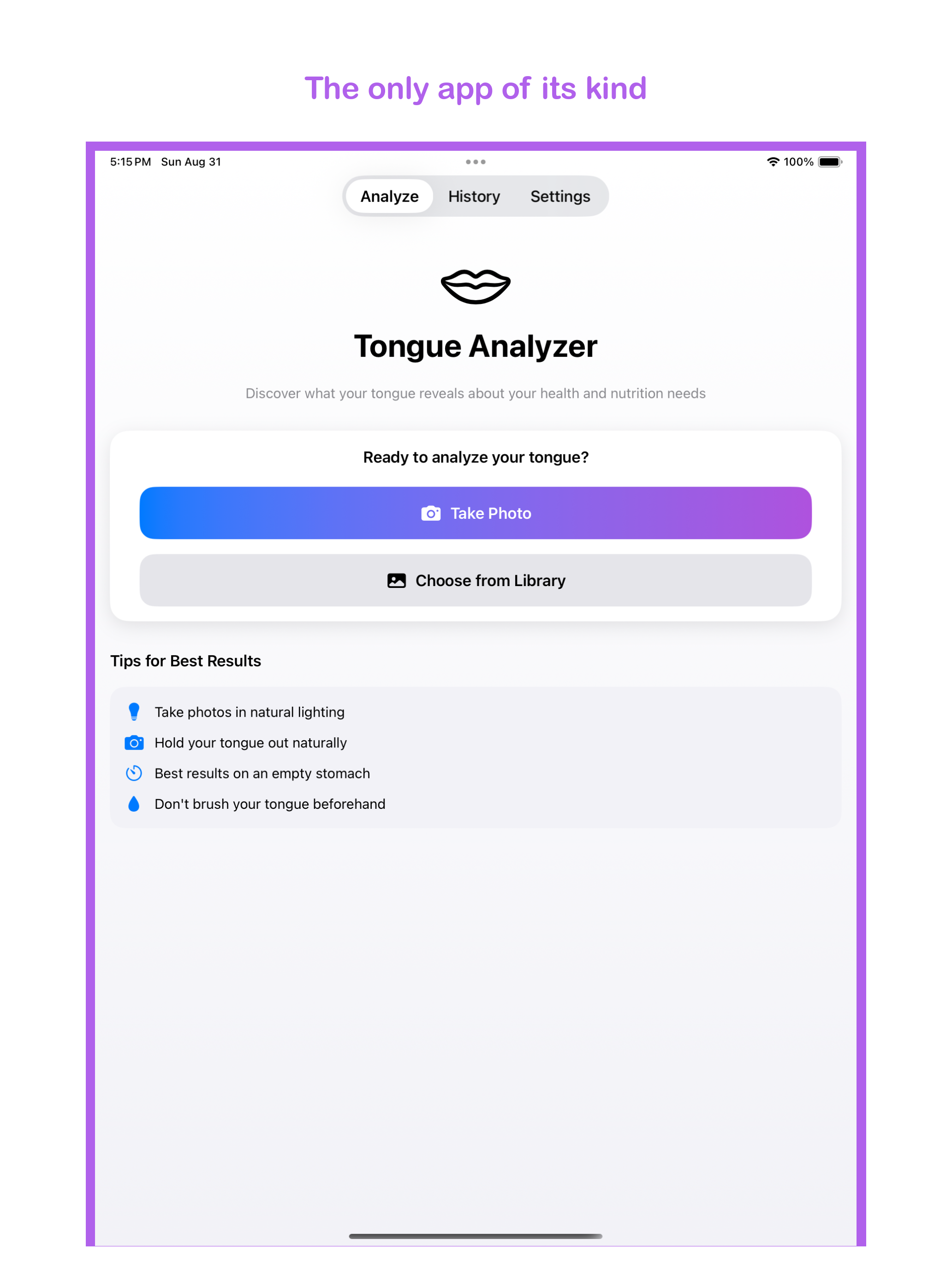 Tongue Analyzer: Dosha & TCM