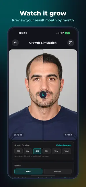 HairArchitect: AI Transplant screenshot 2