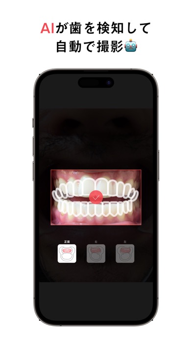 Oh my teeth - Camera Screenshot 6 of 8