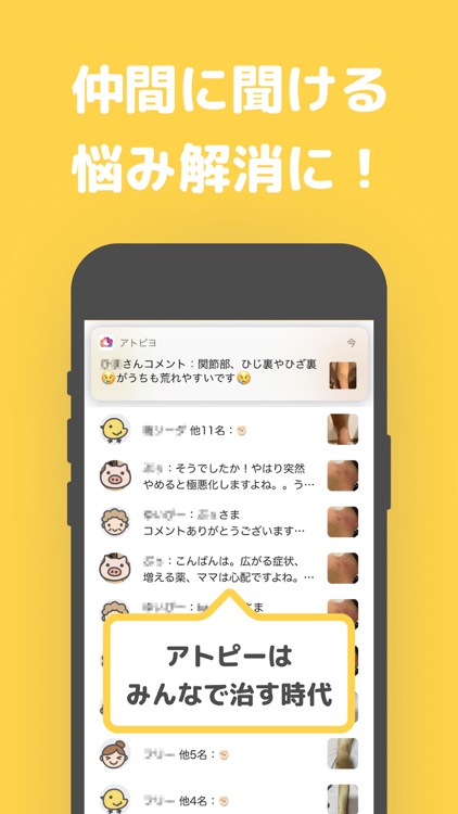 アトピー見える化アプリ-アトピヨ screenshot-4