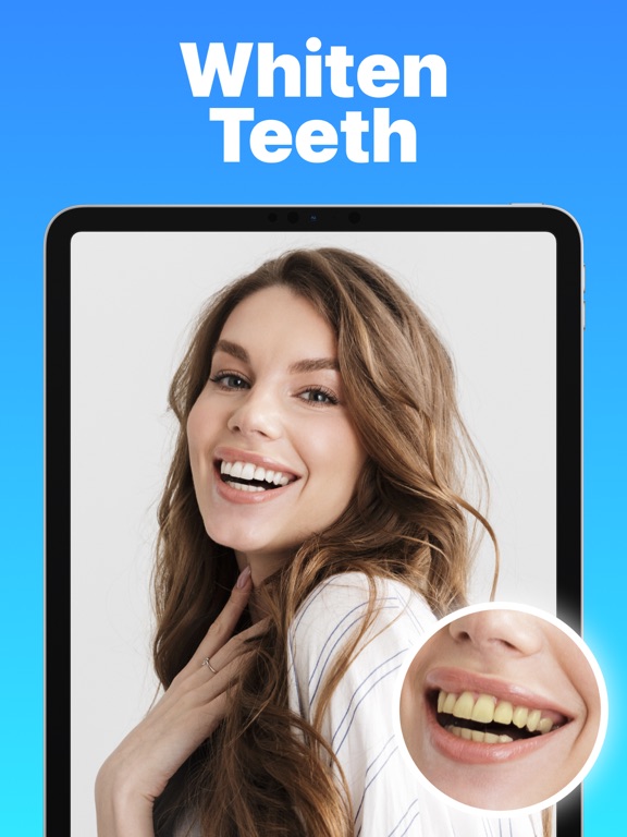 Teeth Whitener & Whitening