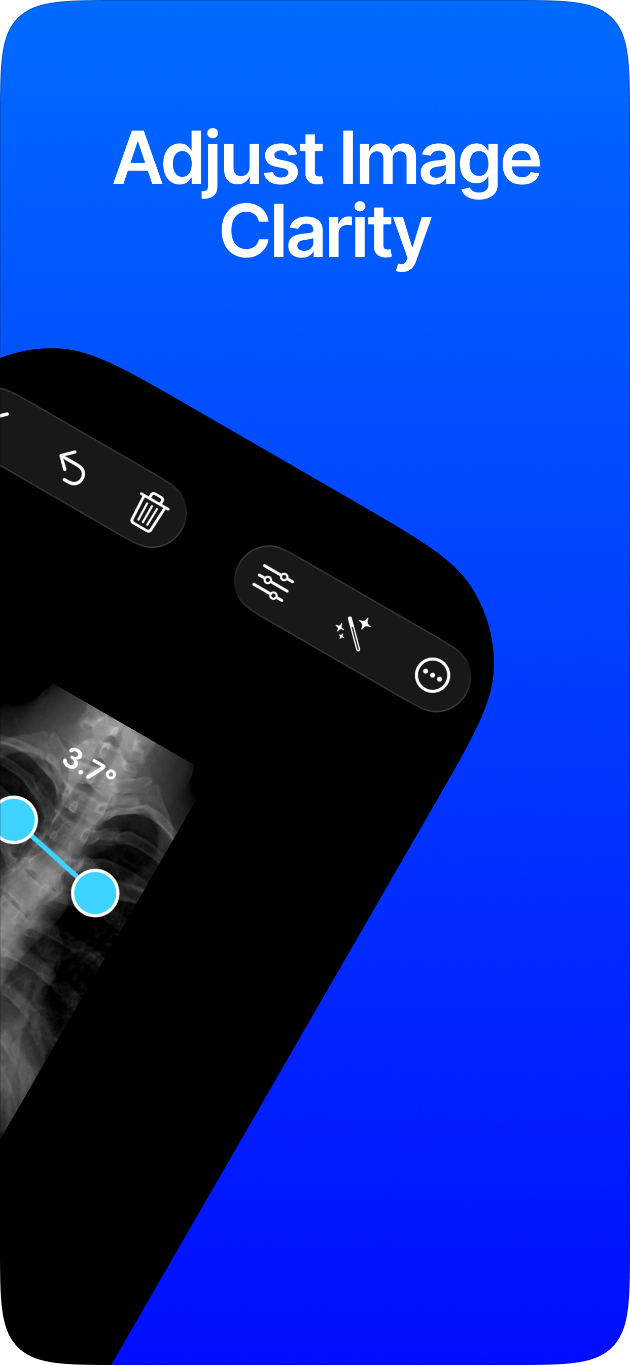 Cobb Angle Pro Spine X-Ray