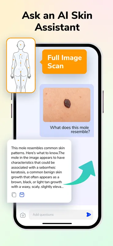 Mole Checker - Skin Scanner screenshot 4 of 4