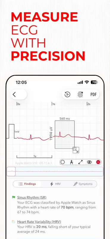 ECG+ | Your Watch ECG Reader screenshot 9 of 9