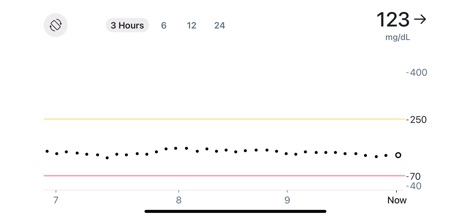 Dexcom Follow - The detailed display showcases precise glucose readings in 'mg/dL' units, presented on a clear graph that defines safe boundaries with visual threshold lines for critical high and low levels.
