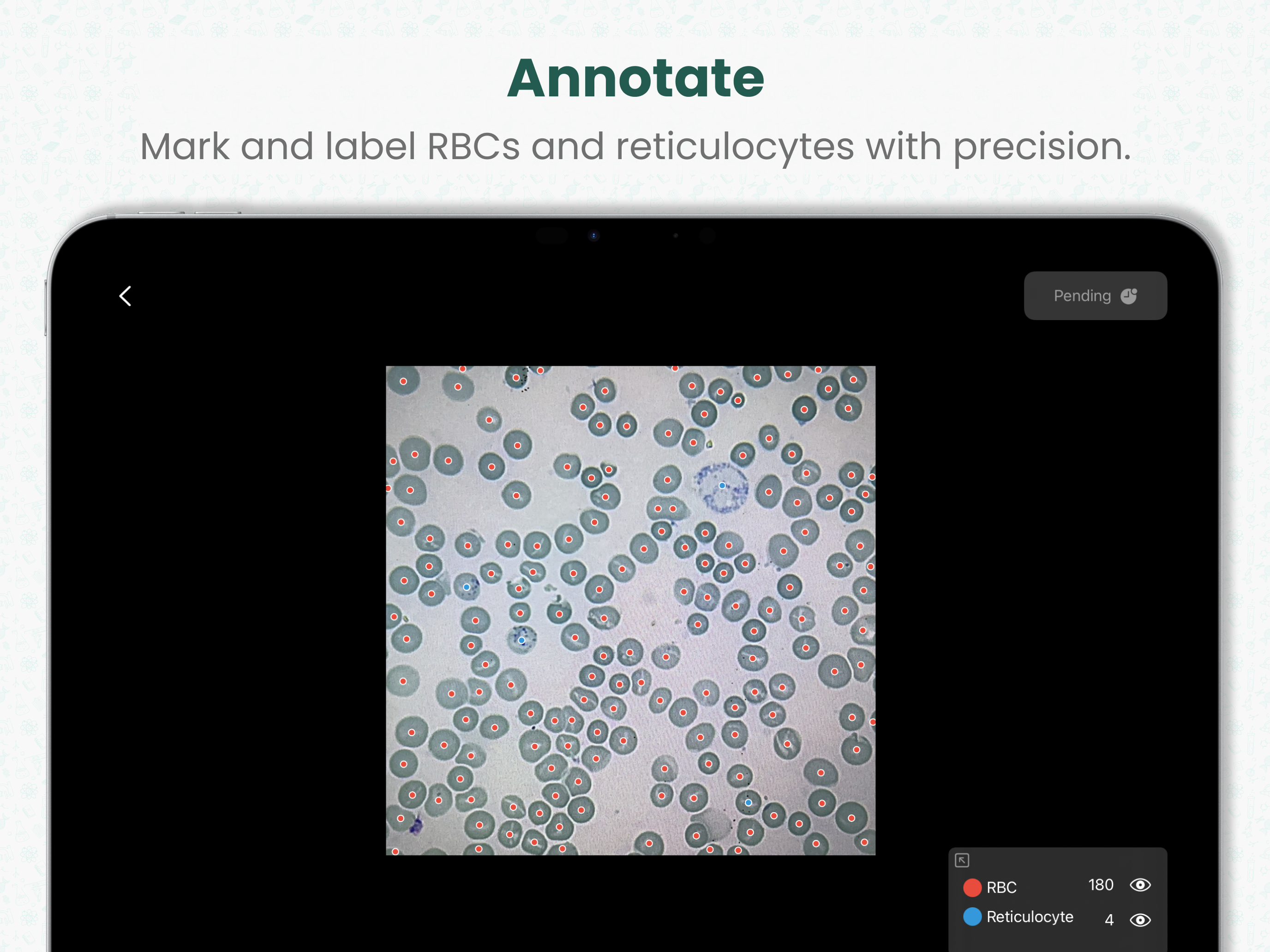 Cilika Reticulocyte screenshot 4